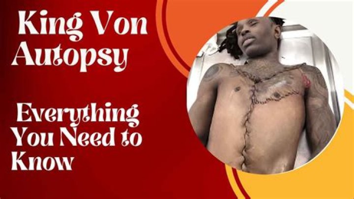 King Von Autopsy: Unveiling the Truth Behind the Tragic Loss