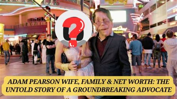 Love Story Adam Pearson and His Dedicated Wife: A Journey of Devotion