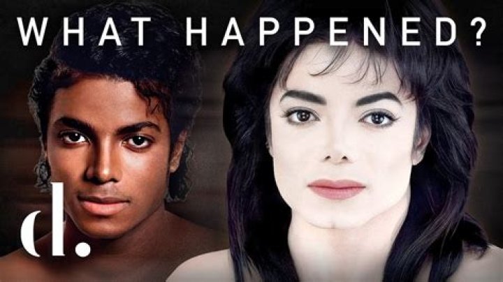 Michael Jackson Skin Bleaching: The Truth Behind the Transformation