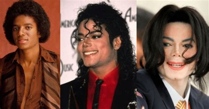 Michael Jackson Skin Disease: The Truth Behind the Transformation