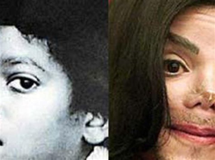 Michael Jackson Skin: The Truth Behind the Transformation
