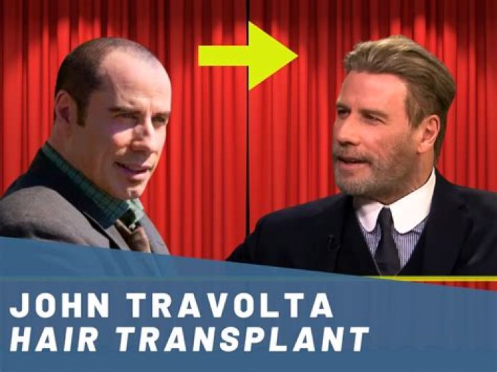 Why Did John Travolta Leave Welcome Back Kotter? Unveiling the Reason Behind His Departure